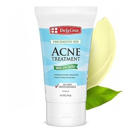 De La Cruz Sulfur Ointment 5% 74g acne treatment for oily and breakout-prone skin in Benin City, Nigeria by Shoptesa Ng